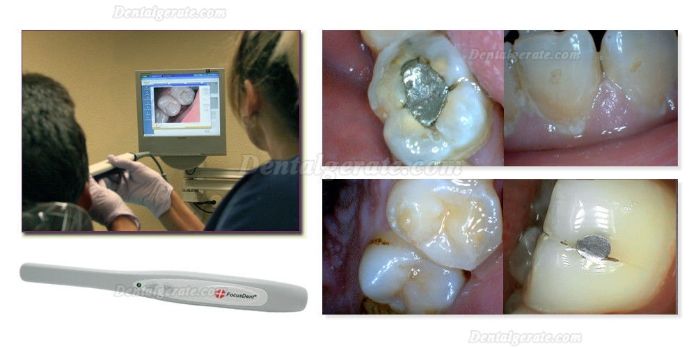 Magenta&reg; MD740 Imaging USB Intraorale Kamera